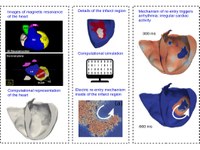 Un nuevo procedimiento de simulación permite nuevas perspectivas sobre los latidos ectópicos en el corazón